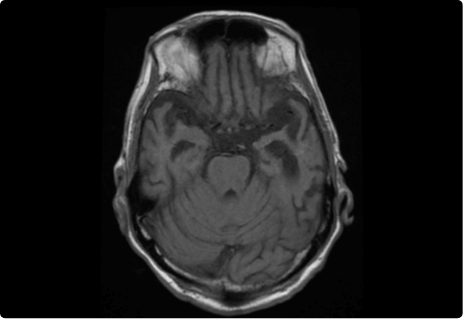 neurosurgery-1